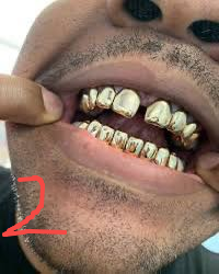https://img.365d4u.com/cos_convert/2025/04/FKbGbL368oG2QdxsO8wcRZSknYP.png